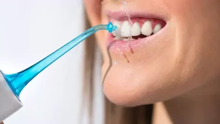 با چه کارهایی دندان زرد میشود 1 d8a8d8a7 da86d987 daa9d8a7d8b1d987d8a7db8cdb8c d8afd986d8afd8a7d986 d8b2d8b1d8af d985db8cd8b4d988d8af 6705ec164a8a2