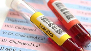 علائم کم خونی را بشناسید 4 d8b9d984d8a7d8a6d985 daa9d985 d8aed988d986db8c d8b1d8a7 d8a8d8b4d986d8a7d8b3db8cd8af 671a5e1416890