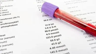 روش های آزمایش ید برای بدن | نتیجه آزمایش ید برای بدن 2 d8b1d988d8b4 d987d8a7db8c d8a2d8b2d985d8a7db8cd8b4 db8cd8af d8a8d8b1d8a7db8c d8a8d8afd986 d986d8aadb8cd8acd987 d8a2d8b2d985d8a7db8c 67f3548f6f476