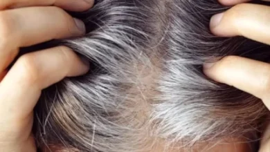 درمان موهای سفید ممکن شد/ خبر خوب برای آن هایی که موهایشان سفید شده است 6 d8afd8b1d985d8a7d986 d985d988d987d8a7db8c d8b3d981db8cd8af d985d985daa9d986 d8b4d8af d8aed8a8d8b1 d8aed988d8a8 d8a8d8b1d8a7db8c d8a2 68ef77b24ce3b