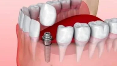 da86d8b1d8a7 d8a7db8cd985d9bed984d986d8aa d8afd986d8afd8a7d986d985 d984d982 d8b4d8afd987 d8a7d8b3d8aad89f d8afd8b1d985d8a7d986 d984d982 68ffb9f94968d