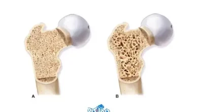 d8a7db8cd986 d988db8cd8aad8a7d985db8cd986 d987d8a7 d8a8d8b1d8a7db8c d9bed988daa9db8c d8a7d8b3d8aad8aed988d8a7d986 d985d8b9d8acd8b2d987 69373518d6e59